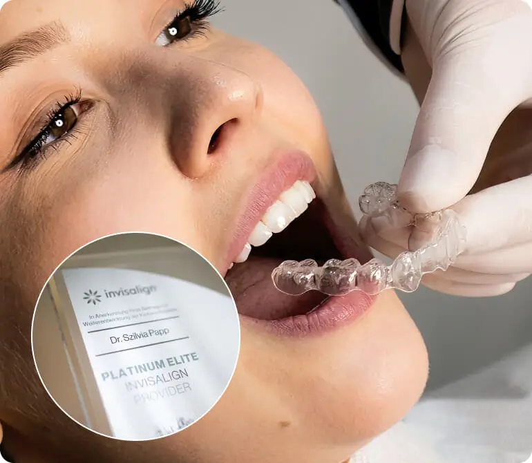 Invisalign unsichtbare Zahnspange